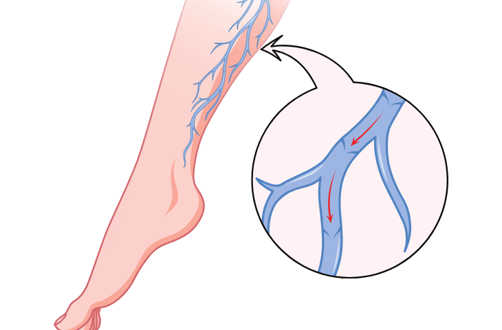 Creme per le Vene: Guida Completa per il Benessere delle Gambe